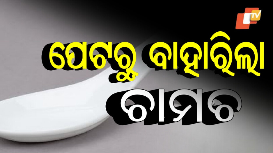 Man Swallows Spoon: ୬ ମାସ ପରେ ପେଟରୁ ବାହାରିଲା ଚାମଚ, ଆଶ୍ଚର୍ଯ୍ୟ କରିଦେବ ଏହି ଖବର...