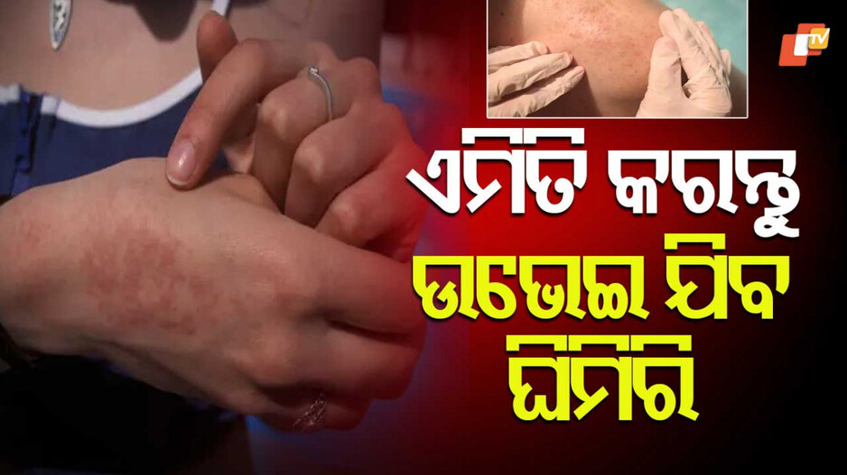 Summer Skin Care Tips: ଏହି ସବୁ ଉପାୟ କଲେ ଖରାଦିନେ ଦେଖାଯିବନି ଚର୍ମ ସମସ୍ୟା, ପୂରା ଚମକିବ