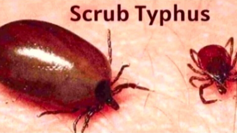 Scrub Typhus claims another life in Odisha