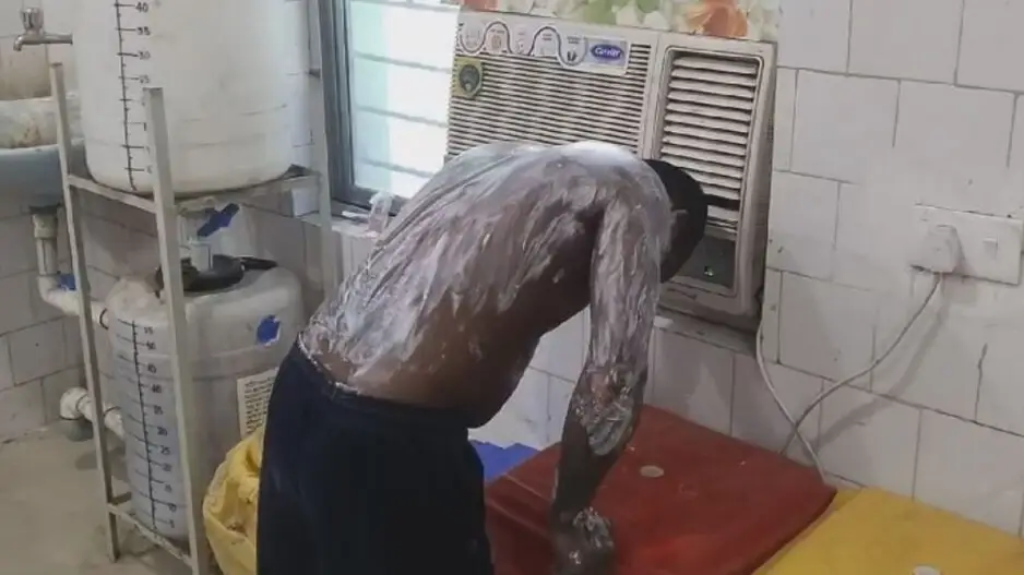Woman sets herself on fire over family dispute, husband critical while saving her in Balasore