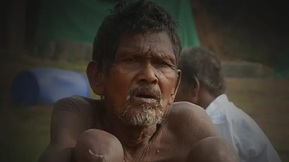 Patients suffer as Cuttack SCB special ward for destitute runs beyond capacity
