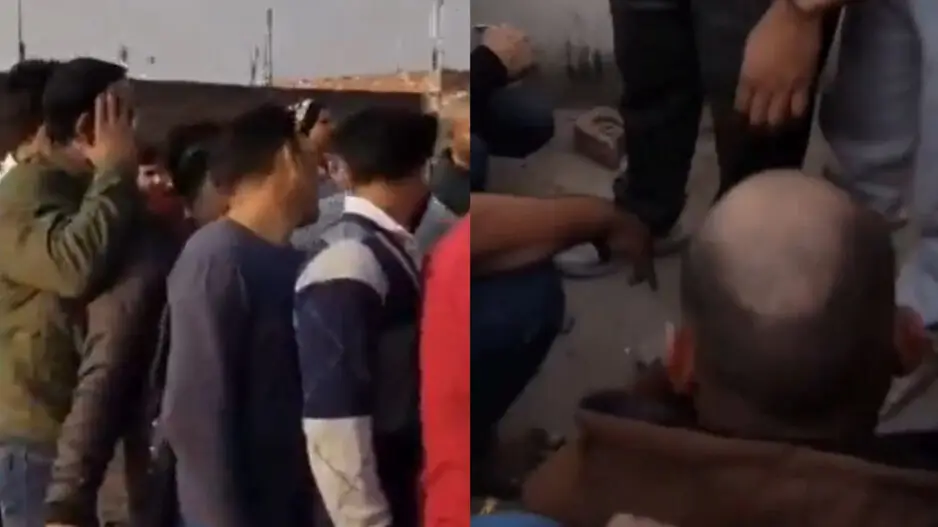 Hair loss reversing ‘medicine’ at Rs 20! People rush for treatment; video goes viral