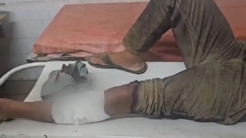 Rourkela dhaba owner shot at by looters in robbery attempt; 2 criminals injured in police encounter